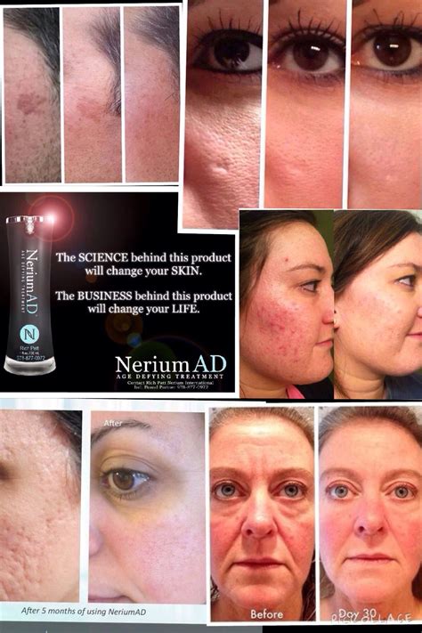 Pin on Nerium results