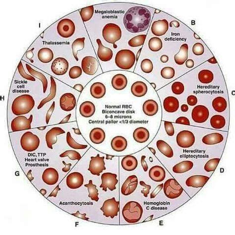 10+ Hematology Slides ideas in 2020 | hematology, medical lab ...