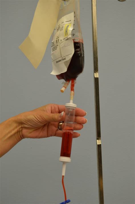 8.7 Transfusion of Blood and Blood Products – Clinical Procedures for ...