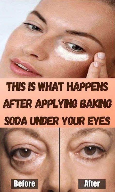 Pin on eye bag removal tricks