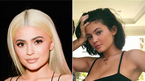 Kylie Jenner Removed Her Lip Filler | Teen Vogue