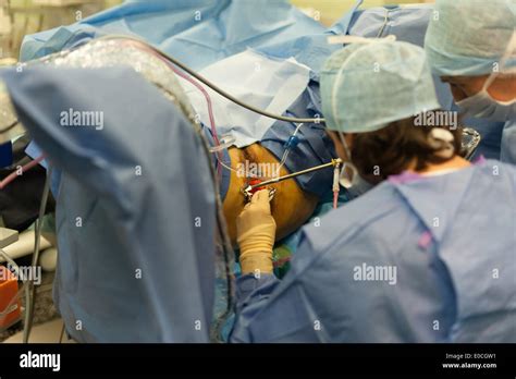 Gynecological surgery Stock Photo: 69118141 - Alamy