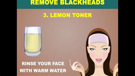 Simple Home Remedies To Remove Blackheads - YouTube