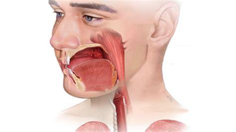 Tonsil Cancer: Causes, Symptoms, Treatment, and Prognosis