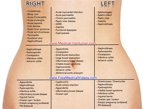 Abdominal Pain Causes By Location And Quadrant Differential Diagnosis | My XXX Hot Girl