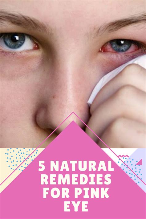 5 Natural Remedies for Pink Eye - Health & Fitness