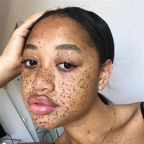 How To Get Freckles With Dark Skin How To Do Thing | Images and Photos finder