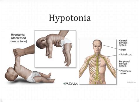 What Is Muscle Tone, And Why Is It Important? | Nutrition Realm