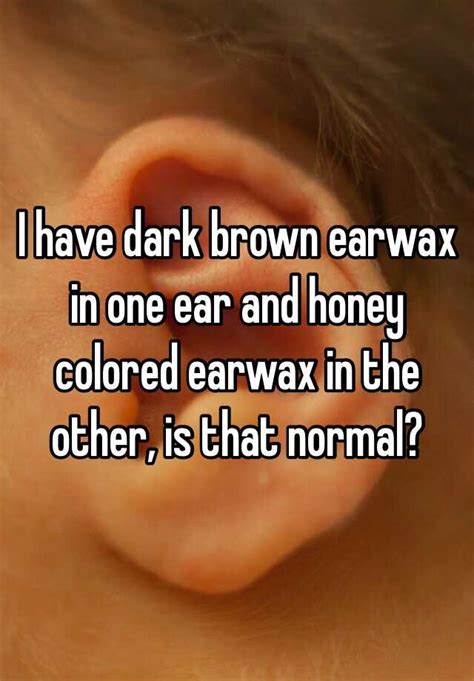 I have dark brown earwax in one ear and honey colored earwax in the other, is that normal?
