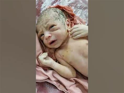 Newborn Baby just after birth with body stained with meconium#shorts #viral #baby - YouTube