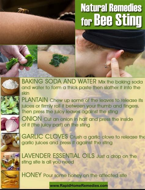 20 Soothing Home Remedies for Bee Sting | Home remedies, Remedies for bee stings, Remedies