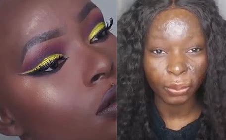 Severe burn survivor and makeup artist turns tragedy into inspiration ...