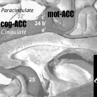 (PDF) Anterior cingulate dysfunction: Implications for psychiatric ...