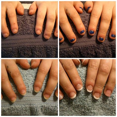 Fabulous before and after pictures. Bio sculpture gel helping nails to grow long and strong ...