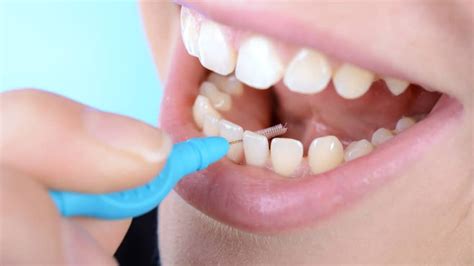 Is Flossing Hard? Interdental Toothbrushes May Be The Answer