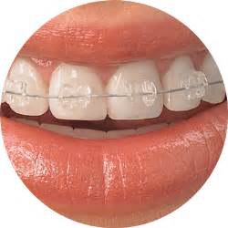 Braces Face Emoji Transparent Png Stickpng | NBKomputer