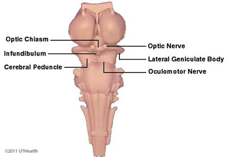 Neuroanatomy Online: Lab 8 - Higher Motor Function - Gross Anatomy ...