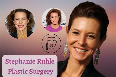 Stephanie Ruhle Did She Undergo Plastic Surgery What - vrogue.co