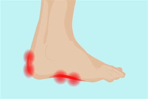 Burning Pain On The Outer-side Of Foot on Sale | emergencydentistry.com