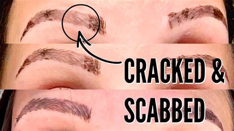 MICROBLADING HEALING PROCESS .... THE FIRST 2 WEEKS! in 2022 | Microblading healing process ...