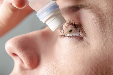 Dry Eye vs. Allergies: Key Signs, Symptoms, and Differences - La Jolla, CA - Del Mar, CA - GW ...