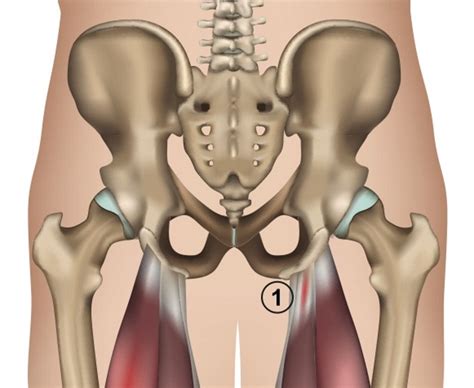 Diagnosing Deep Buttock Pain: A Comprehensive Guide - Sport Doctor London