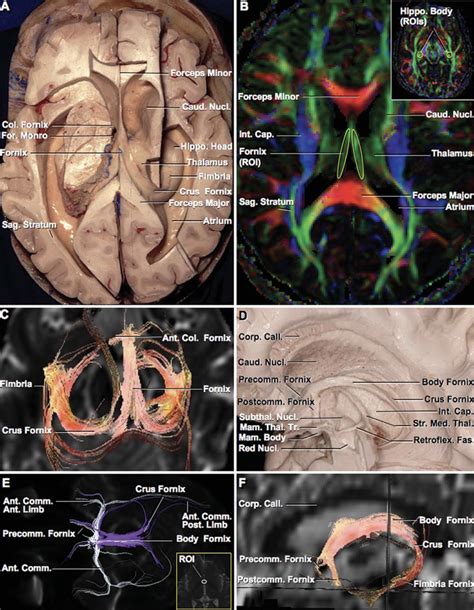 Fornix | Neuroanatomy | The Neurosurgical Atlas