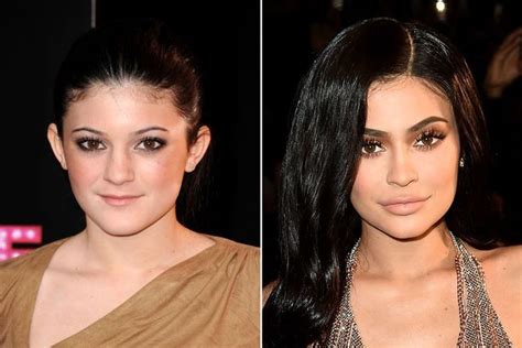 Kylie Jenner - the changing face of the youngest Kardashian | Cejas de ...