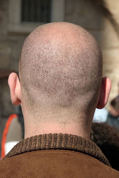 150+ Completely Bald Shaved Head Human Head Rear View Stock Photos ...