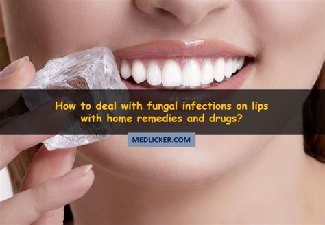 Fungus On Face Treatment - Doctor Heck