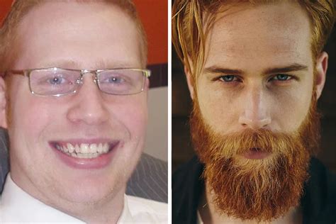 155 Awesome Before And After Photos Of Men Who Underwent Full-On ...