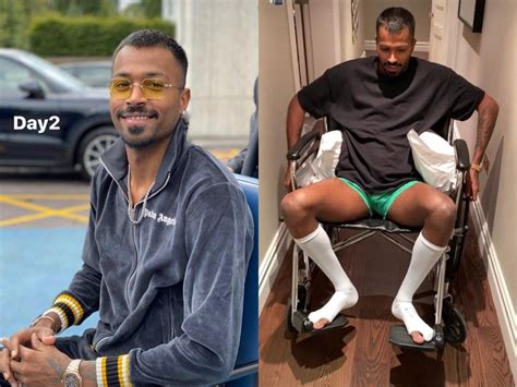 Hardik Pandya injury: [VIDEO] Hardik Pandya walks on crutches after surgery, Twitterati wishes ...