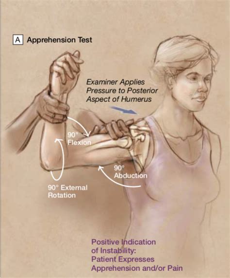 Shoulder Impingement Syndrome Test