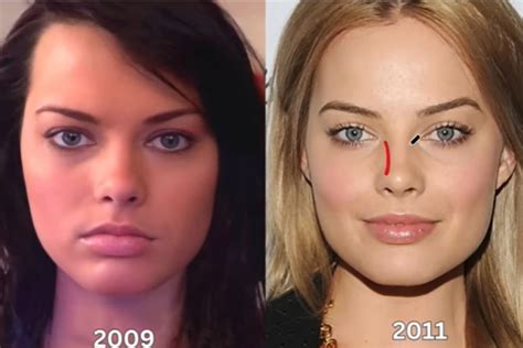 How many plastic surgeries did Margot Robbie get done to look like the ...