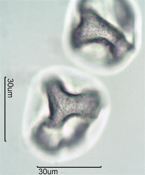 Grass (Family Poaceae) Pollen Under the Microscope