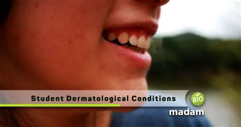 Student Health 101: Common Dermatological Conditions and Treatment Options - biomadam