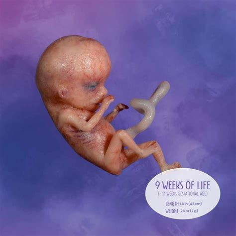 “Fetus” Stage: Week 9 in the Life of an Unborn Baby | Answers in Genesis