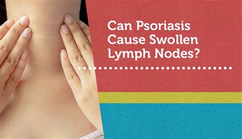 Can Psoriasis Cause Swollen Lymph Nodes? | MyPsoriasisTeam