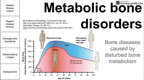 Metabolic Bone Disorders - YouTube