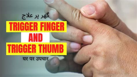 Fix Trigger Finger and Trigger Thumb At Home - YouTube