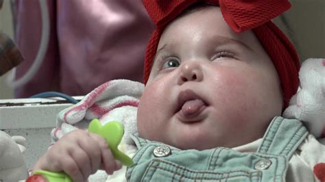 Baby who got heart transplant makes it home for 1st birthday