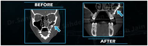 Facial Trauma Surgery - Jaw Correction Surgery