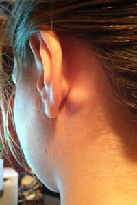 Swollen lymph nodes behind ear - lightingloki