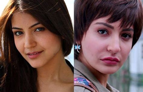 Anushka Sharma Before After