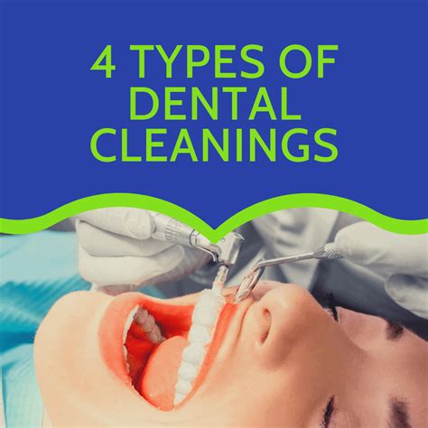 4 Types of Dental Cleanings - Laurich Dentistry