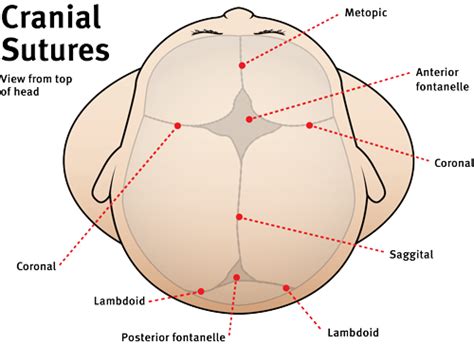 Craniosynostosis | Children's Health Queensland