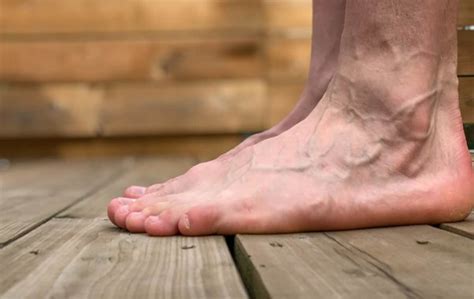 Understanding Bone Spurs on Top of Foot: Causes and Treatments