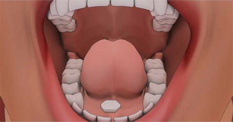 Sublingual Epinephrine Tablet Awaiting Clinical Trials Would Replace ...