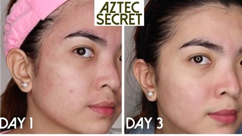 Aztec Healing Clay Mask Results - malayansal