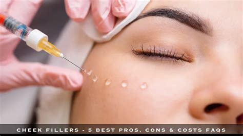 Cheek Fillers – 5 Best Pros, Cons & Costs FAQs – SandiaSkinFace.com